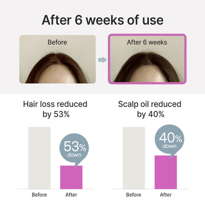 Biotin ampoule for hair loss 100g  (green breeze) - Bvoy Beauty
